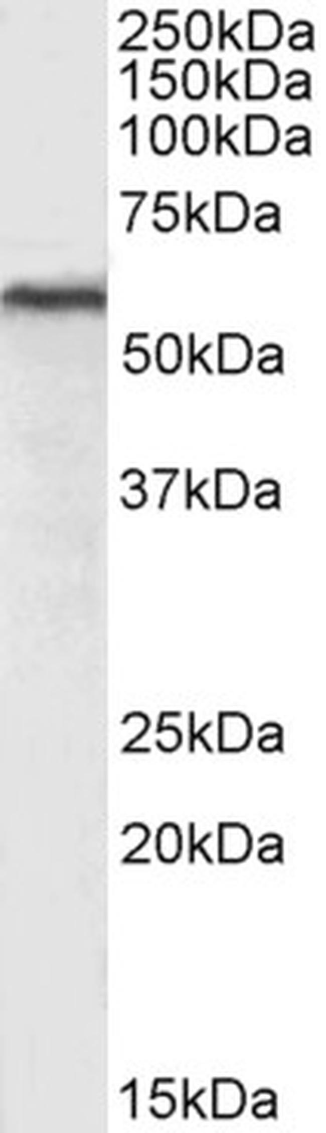 HDAC2 Antibody in Western Blot (WB)