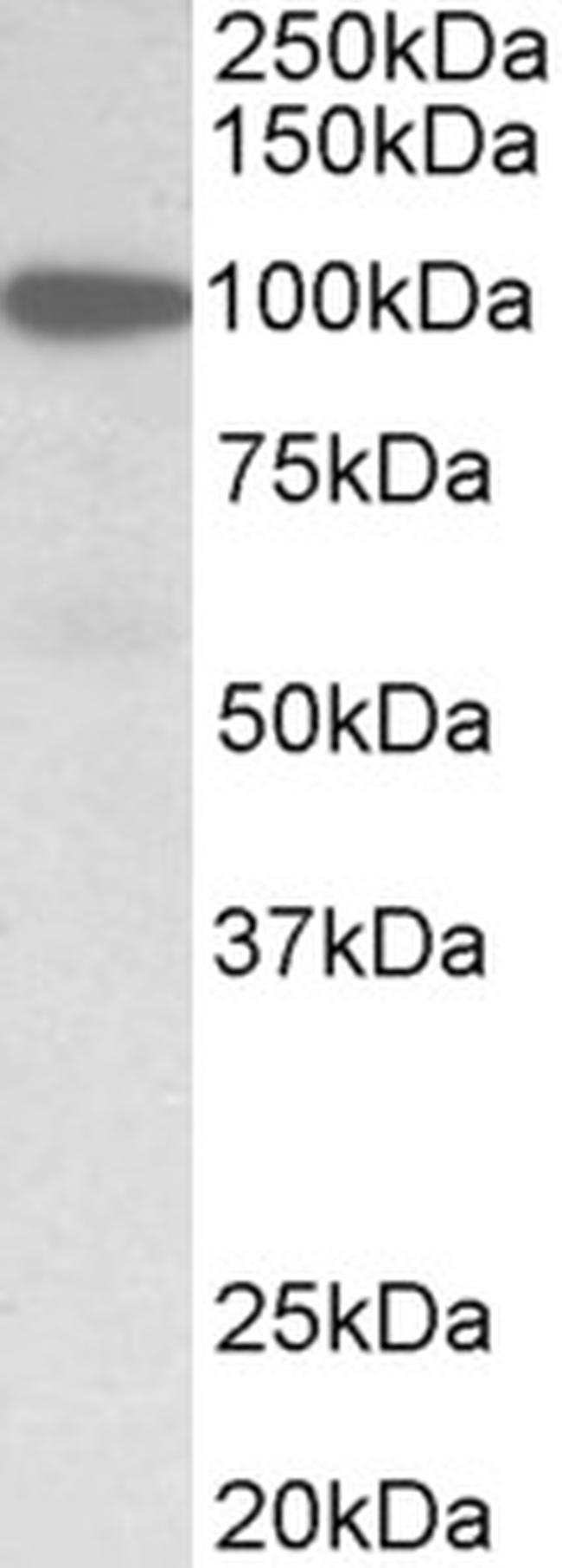 Gelsolin Antibody in Western Blot (WB)