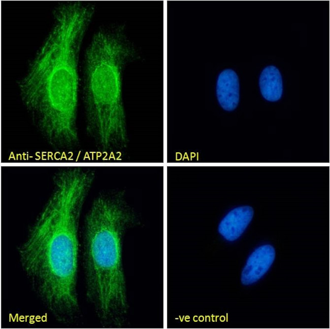 SERCA2 ATPase Antibody in Immunocytochemistry (ICC/IF)