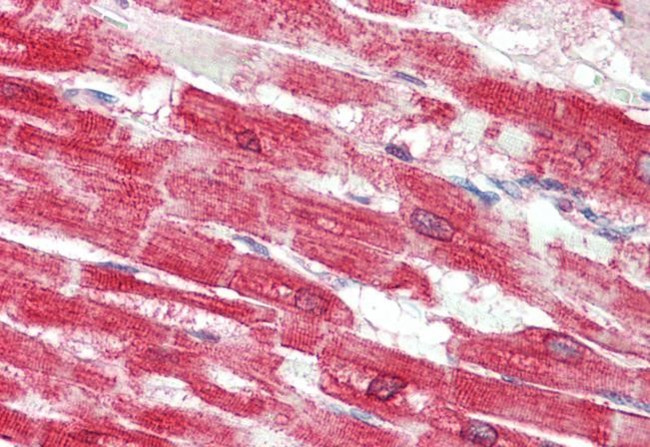 SERCA2 ATPase Antibody in Immunohistochemistry (Paraffin) (IHC (P))