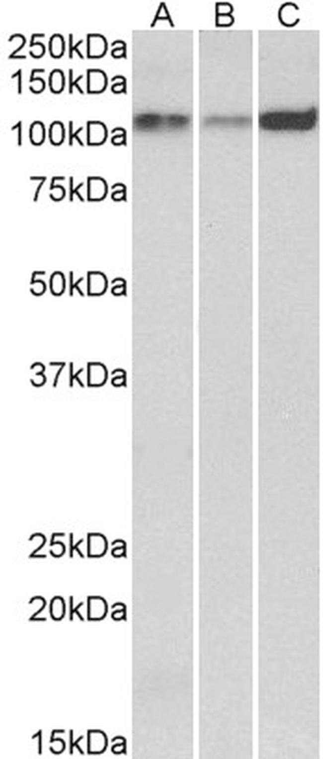 SERCA2 ATPase Antibody in Western Blot (WB)