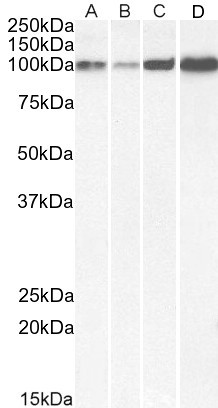 SERCA2 ATPase Antibody in Western Blot (WB)