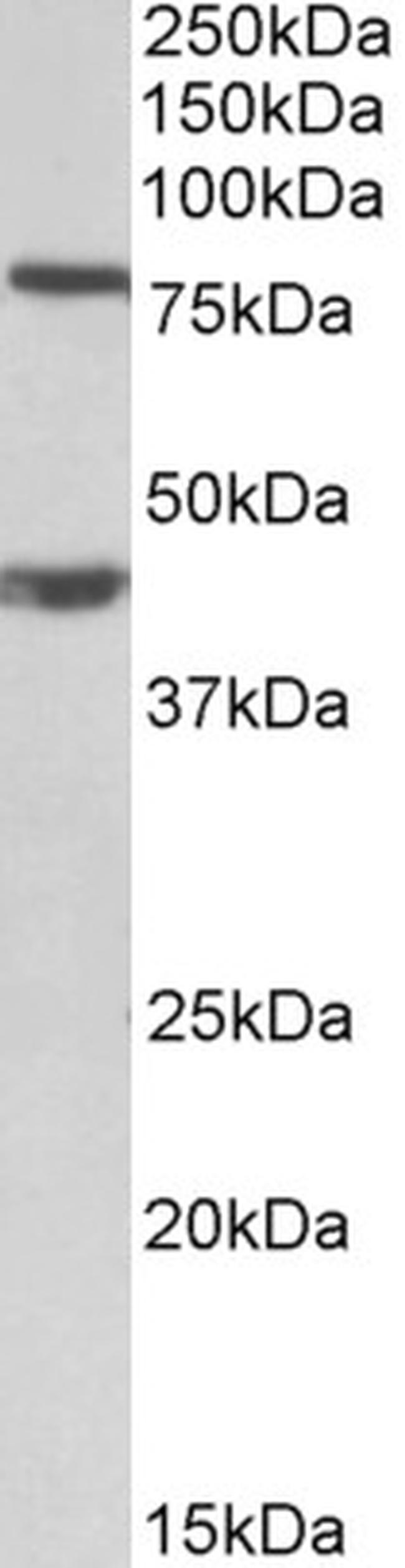 DVL1 Antibody in Western Blot (WB)