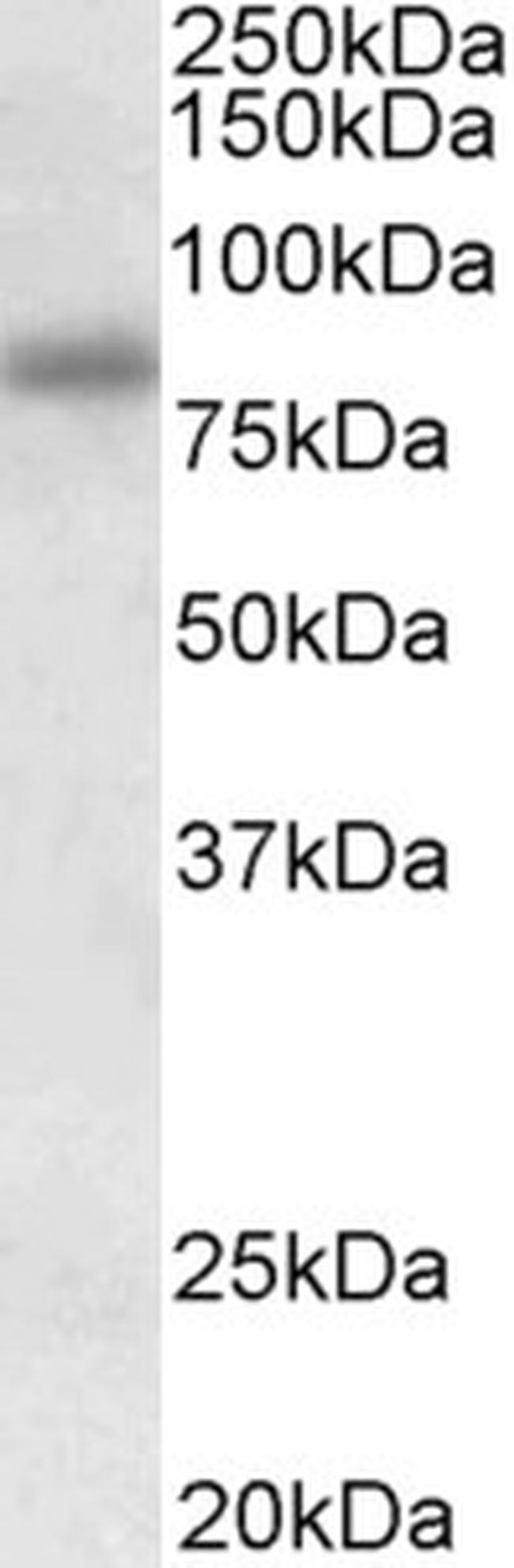 SDCCAG8 Antibody in Western Blot (WB)