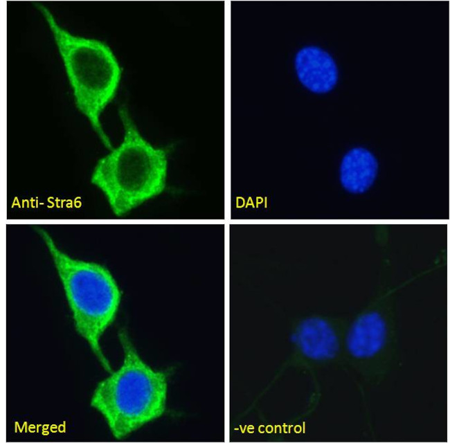 STRA6 Antibody in Immunocytochemistry (ICC/IF)