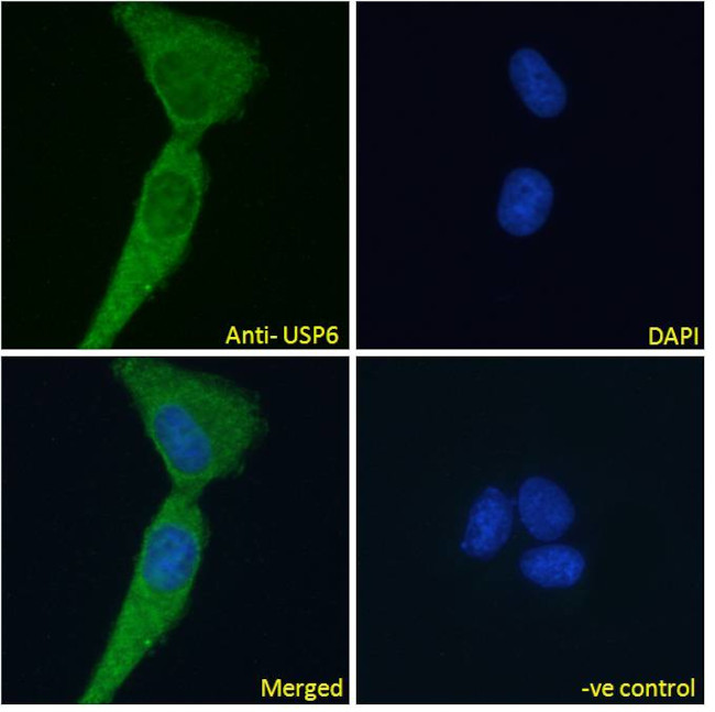 USP6 Antibody in Immunocytochemistry (ICC/IF)