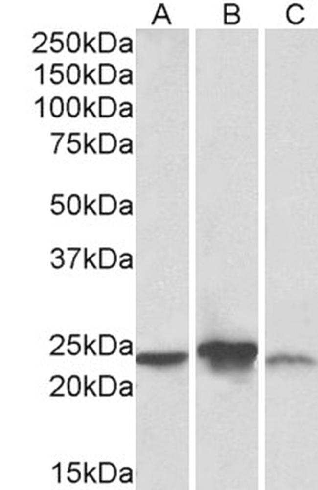 ABHEB Antibody in Western Blot (WB)