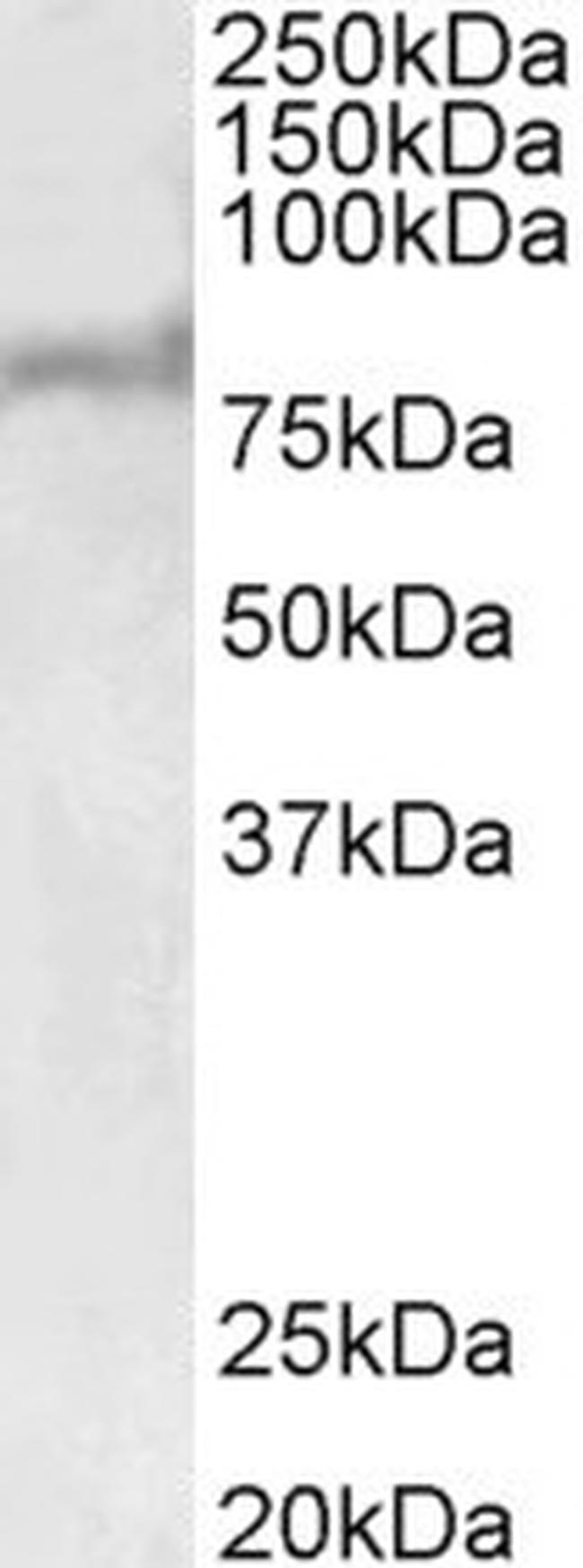 ABCD2 Antibody in Western Blot (WB)