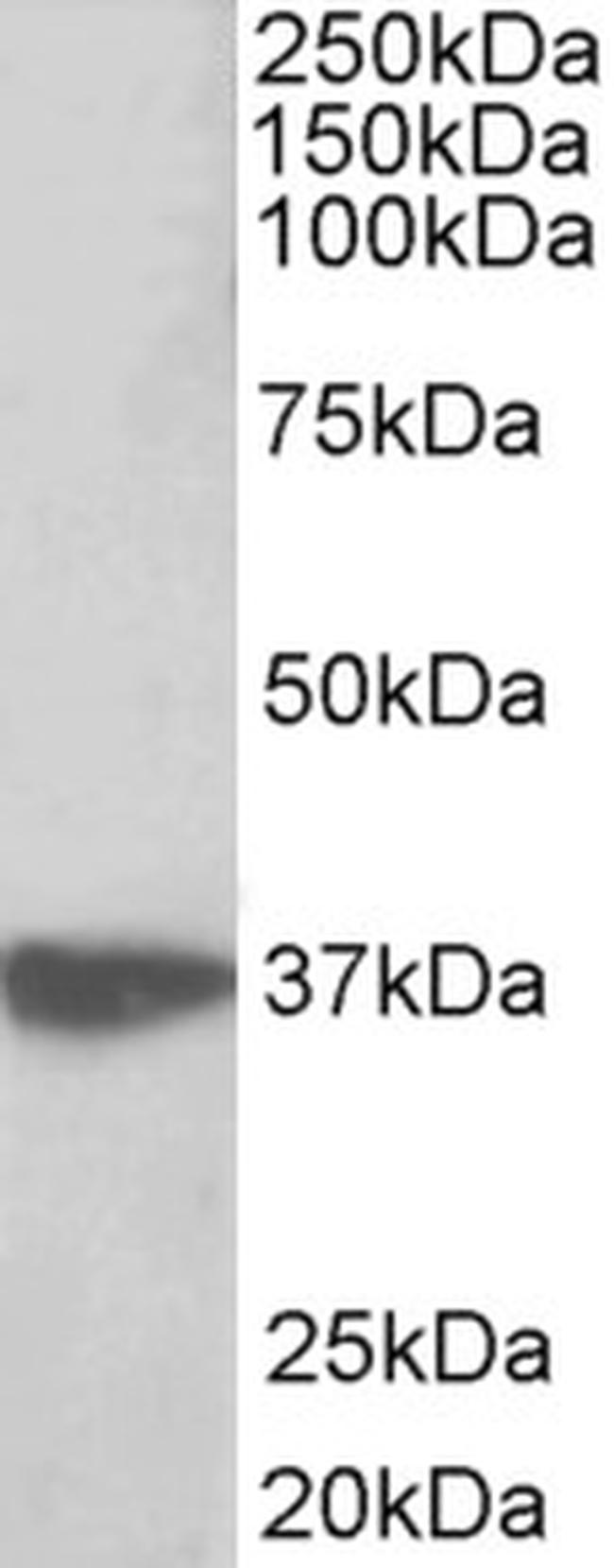 EMAP II Antibody in Western Blot (WB)