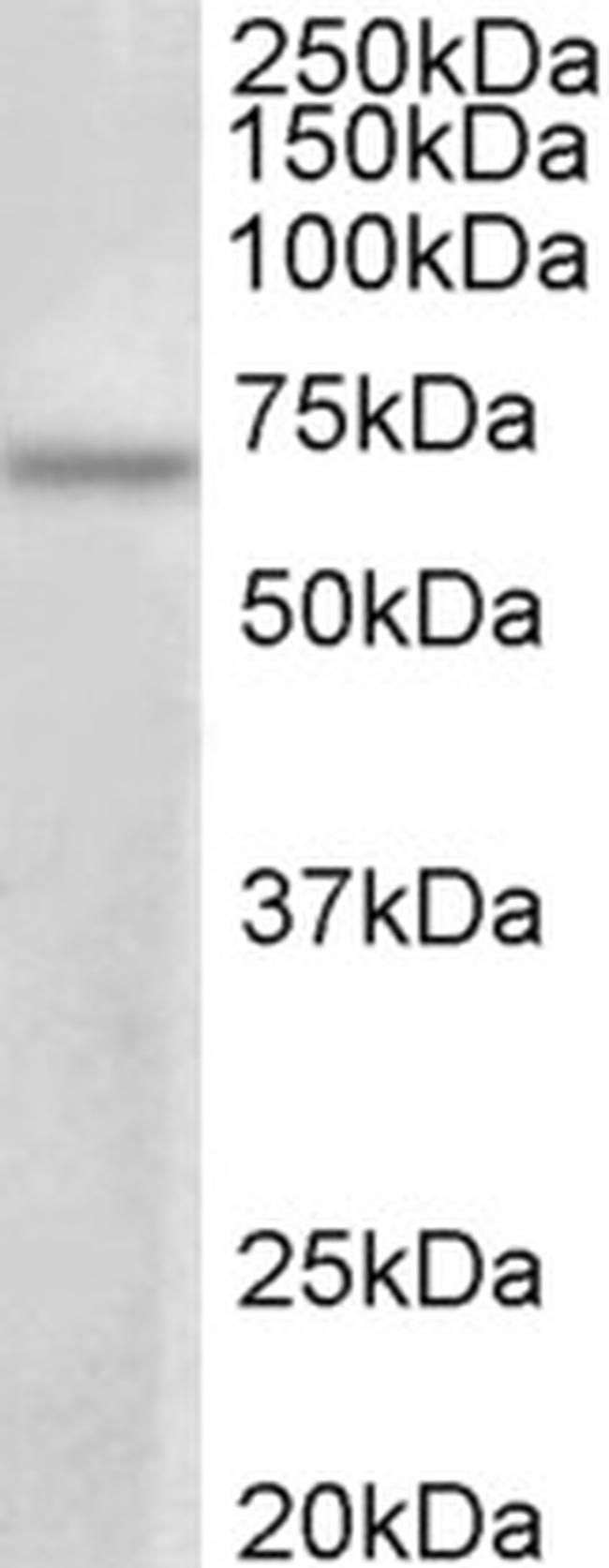 PRMT3 Antibody in Western Blot (WB)