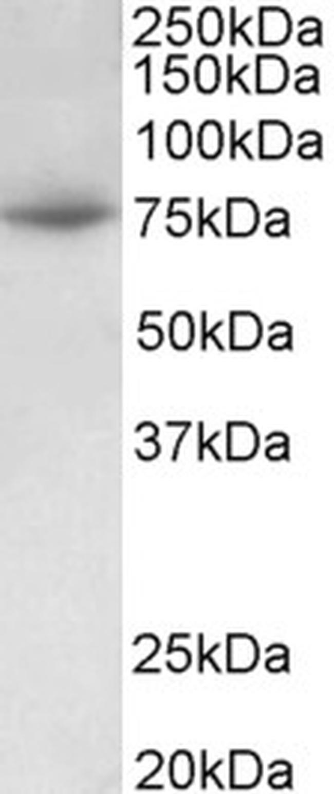 PRMT7 Antibody in Western Blot (WB)