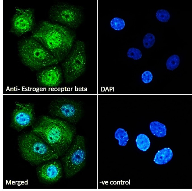 Estrogen Receptor beta Antibody in Immunocytochemistry (ICC/IF)