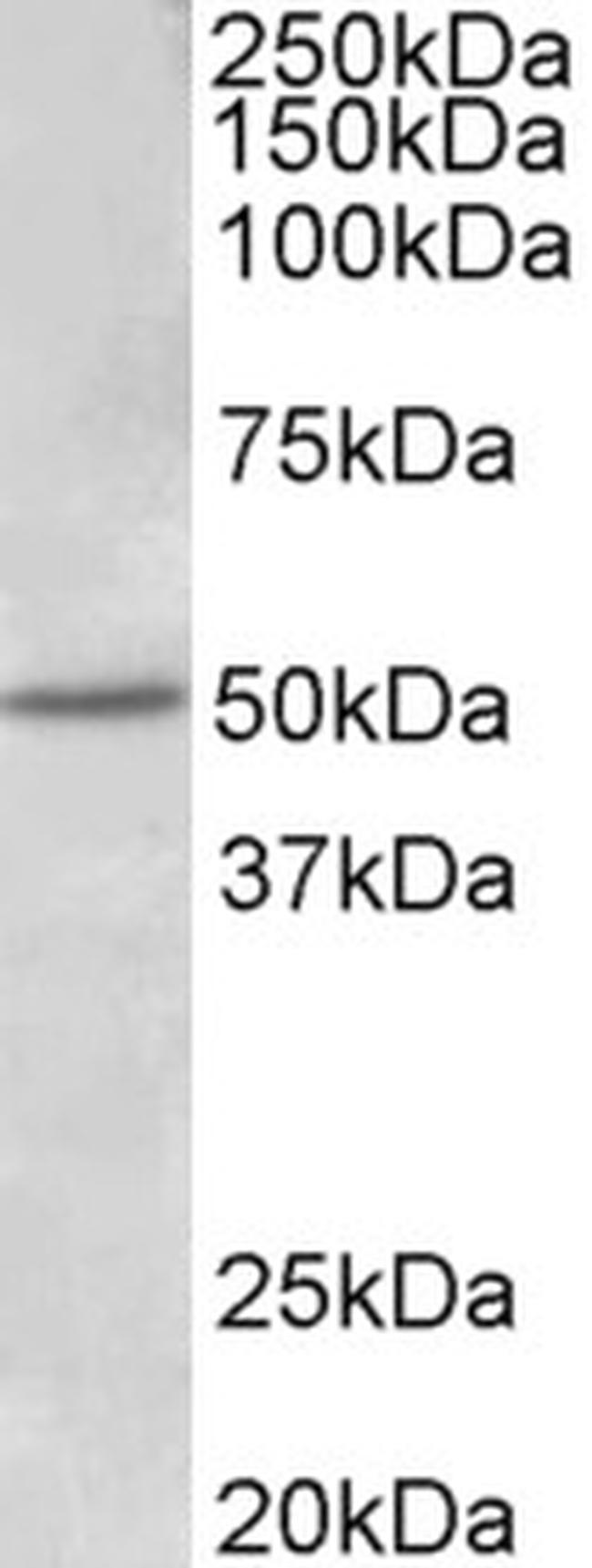 Estrogen Receptor beta Antibody in Western Blot (WB)