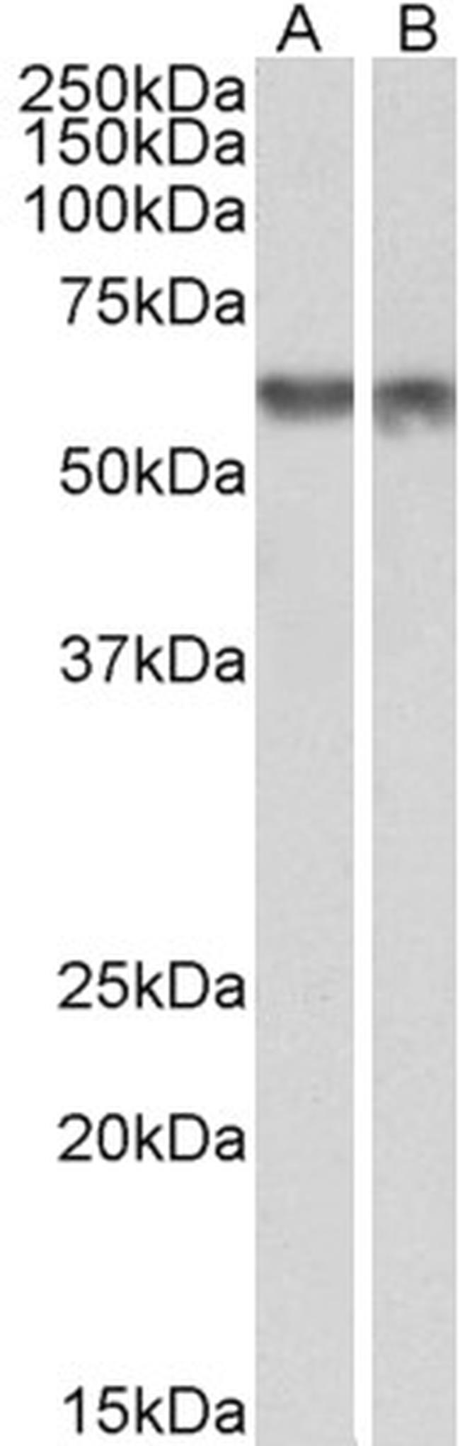 PDCD4 Antibody in Western Blot (WB)