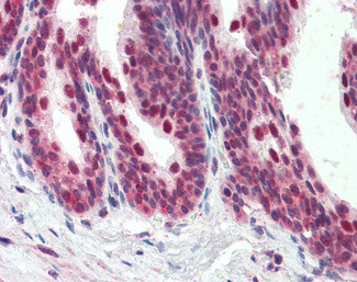 PDCD4 Antibody in Immunohistochemistry (Paraffin) (IHC (P))