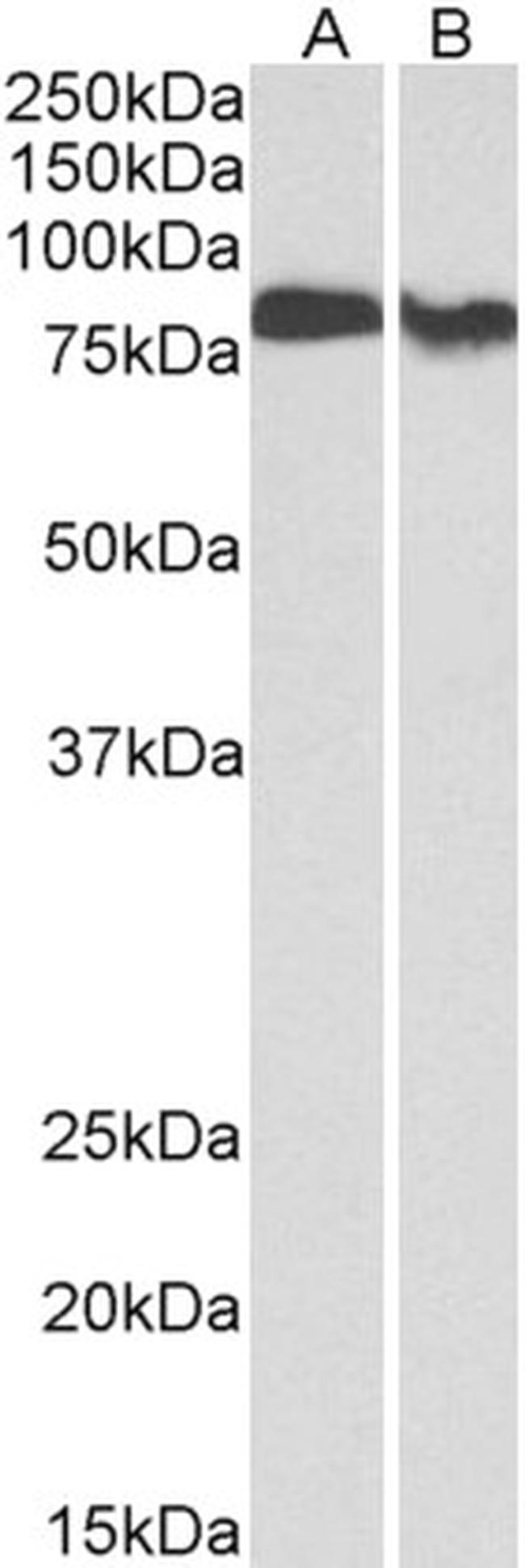 PKC beta Antibody in Western Blot (WB)