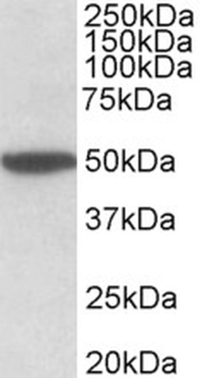 CHRM2 Antibody in Western Blot (WB)