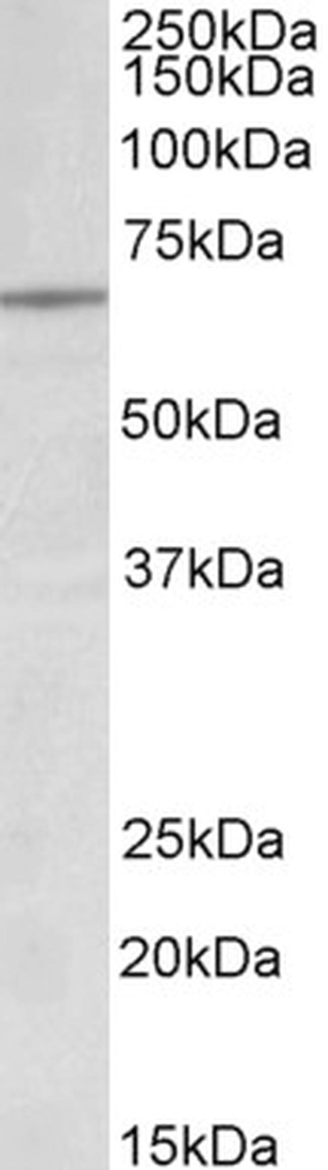 Lamin B1 Antibody in Western Blot (WB)