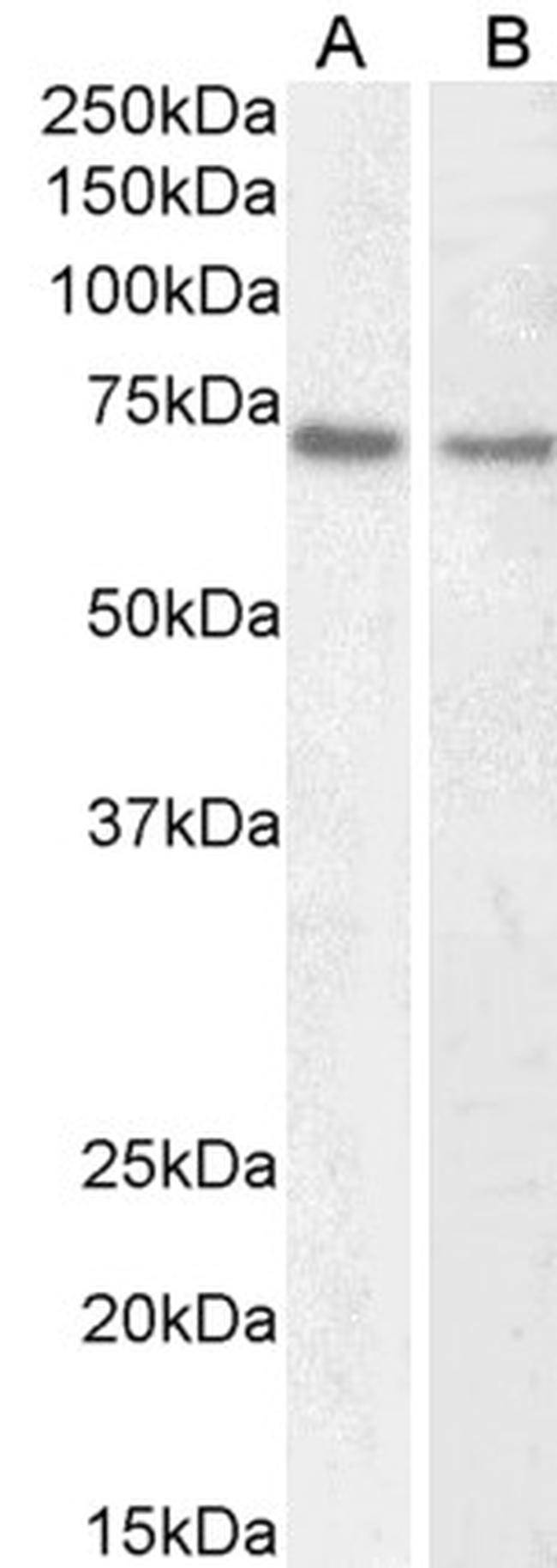 Lamin B1 Antibody in Western Blot (WB)