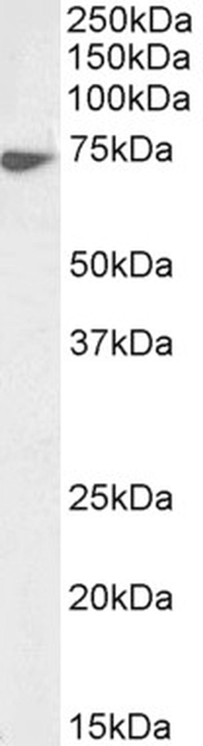 Lamin B1 Antibody in Western Blot (WB)