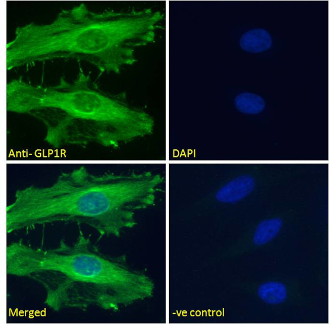 GLP1R Antibody in Immunocytochemistry (ICC/IF)