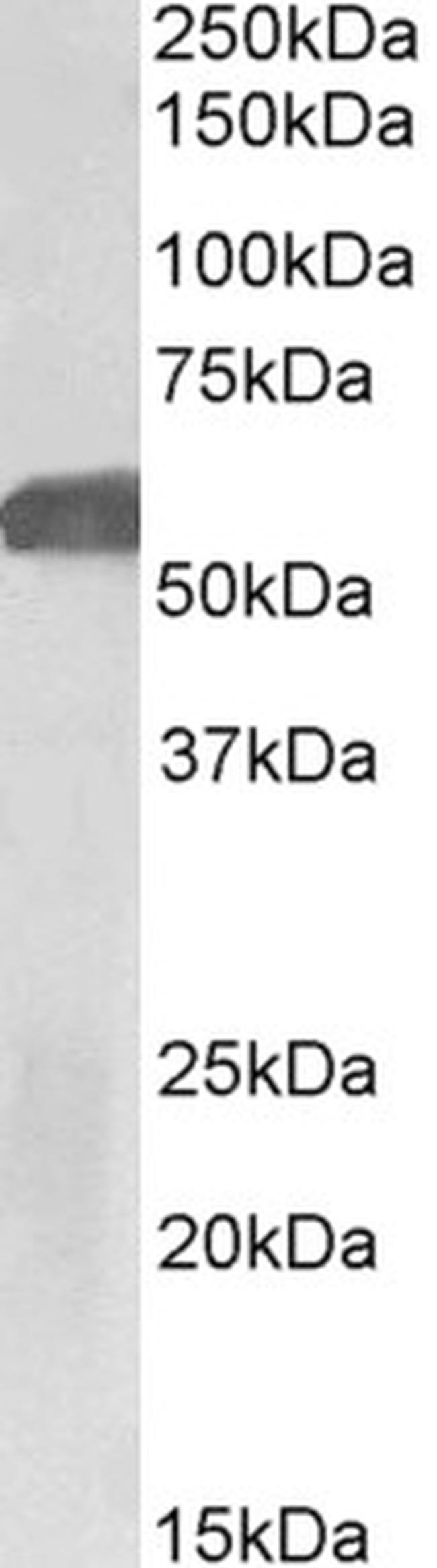 GLP1R Antibody in Western Blot (WB)