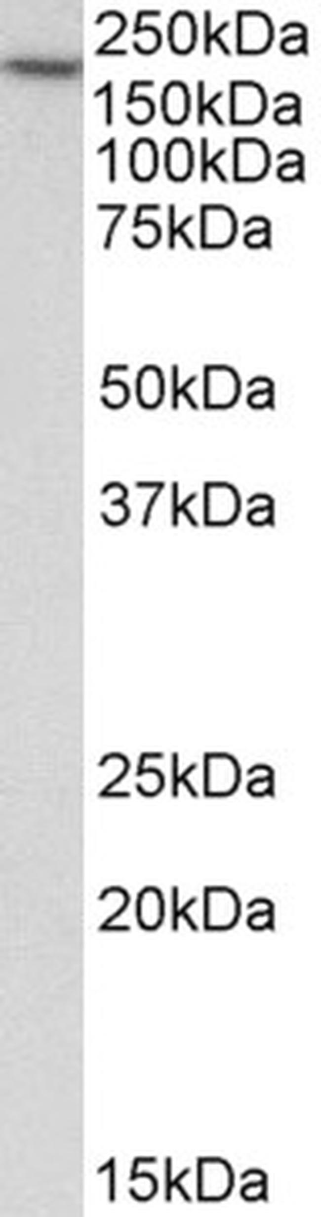 EEA1 Antibody in Western Blot (WB)