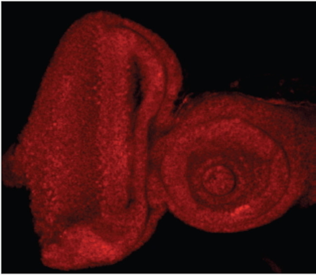 E2F1 Antibody in Immunohistochemistry (IHC)