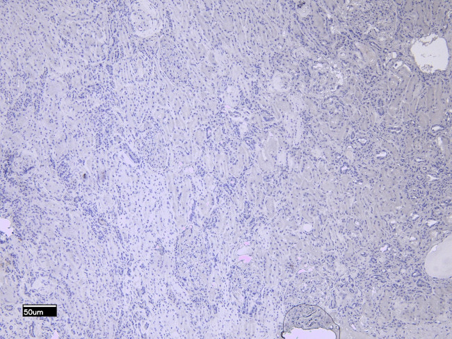 MMP3 Antibody in Immunohistochemistry (Paraffin) (IHC (P))