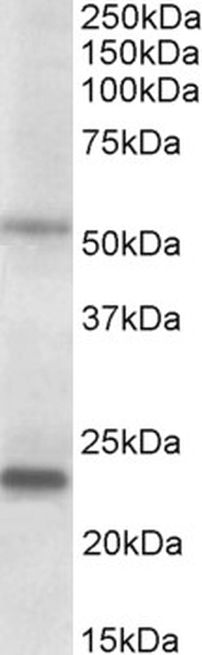 MMP3 Antibody in Western Blot (WB)