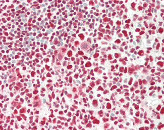 c-Fos Antibody in Immunohistochemistry (Paraffin) (IHC (P))