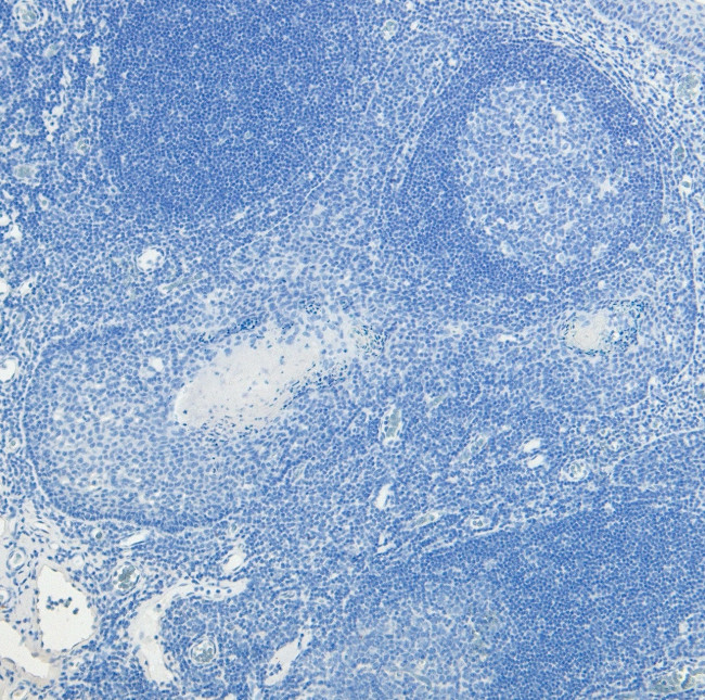 c-Fos Antibody in Immunohistochemistry (Paraffin) (IHC (P))