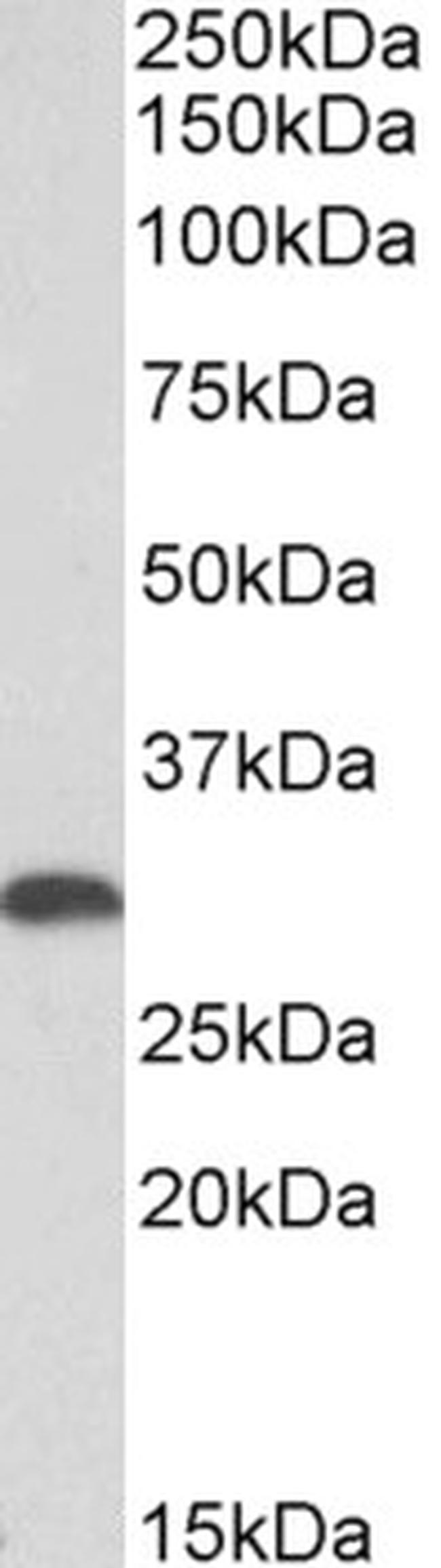 HO-1 Antibody in Western Blot (WB)