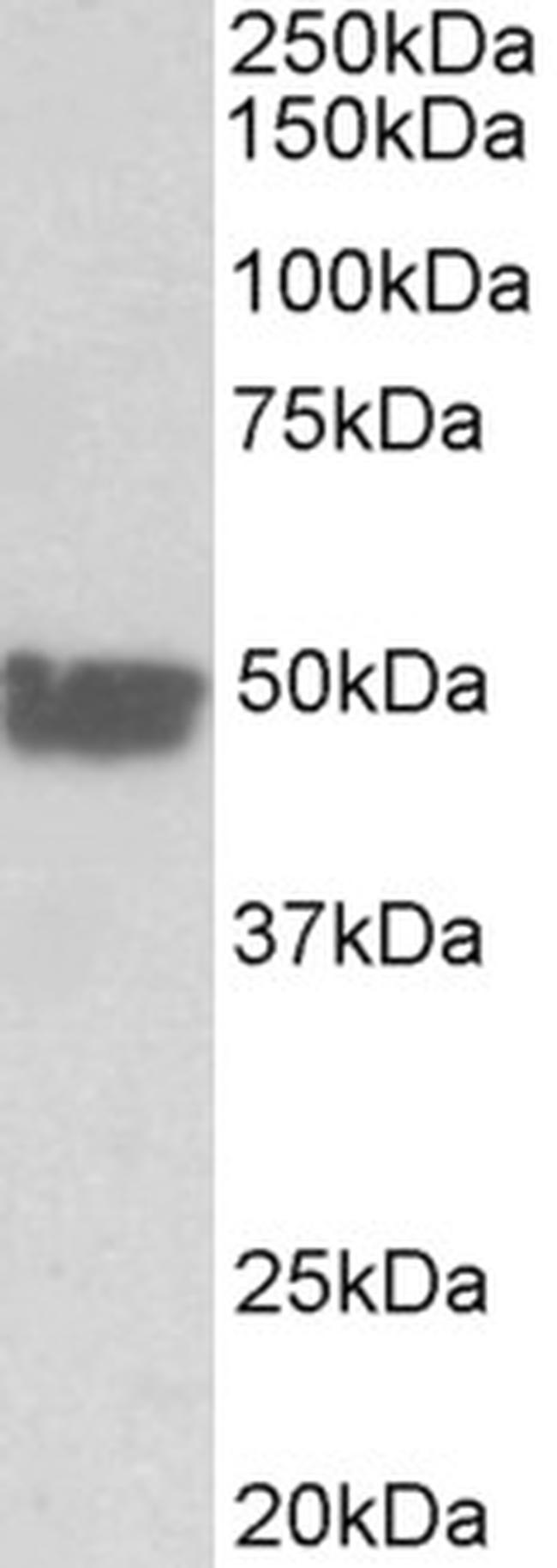 Cytokeratin 20 Antibody in Western Blot (WB)