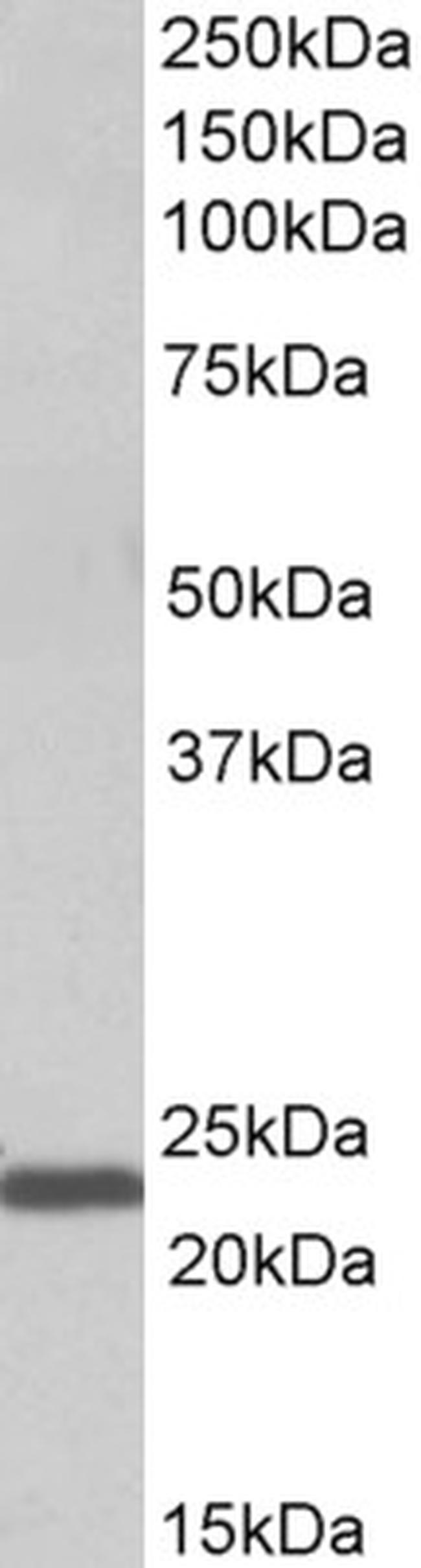 IL-15 Antibody in Western Blot (WB)