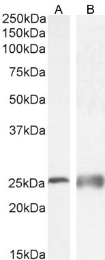 Calbindin D28K Antibody in Western Blot (WB)