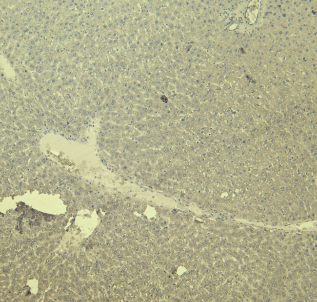 CTGF Antibody in Immunohistochemistry (Paraffin) (IHC (P))