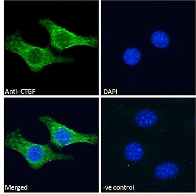 CTGF Antibody in Immunocytochemistry (ICC/IF)