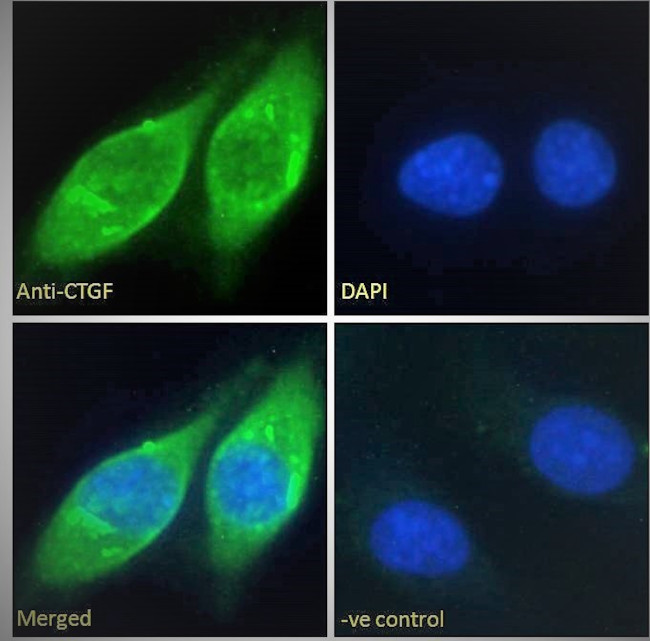 CTGF Antibody in Immunocytochemistry (ICC/IF)