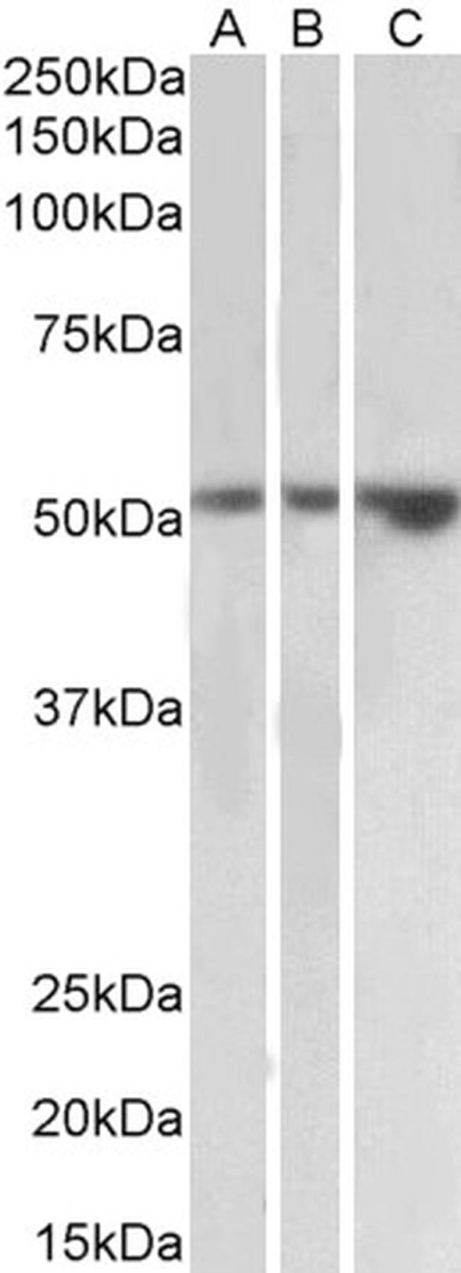 KIM-1 Antibody in Western Blot (WB)