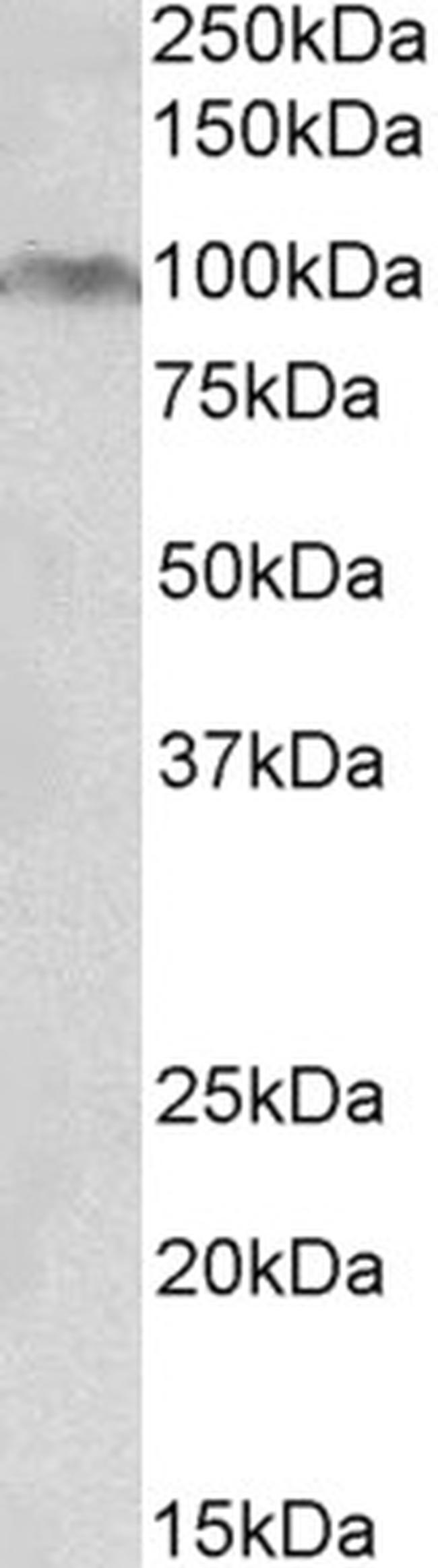 AHR Antibody in Western Blot (WB)