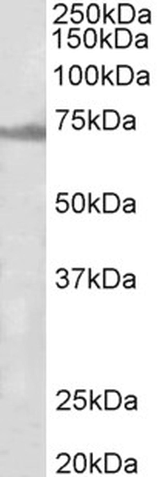 ENC1 Antibody in Western Blot (WB)