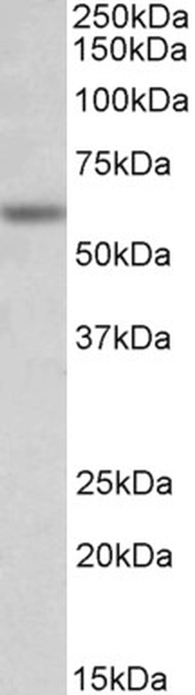 GLRA1 Antibody in Western Blot (WB)