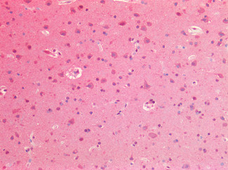 VCP Antibody in Immunohistochemistry (Paraffin) (IHC (P))