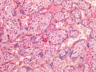 VCP Antibody in Immunohistochemistry (Paraffin) (IHC (P))