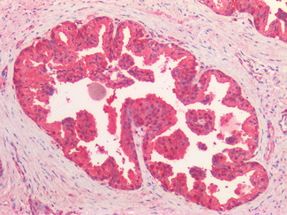 VCP Antibody in Immunohistochemistry (Paraffin) (IHC (P))