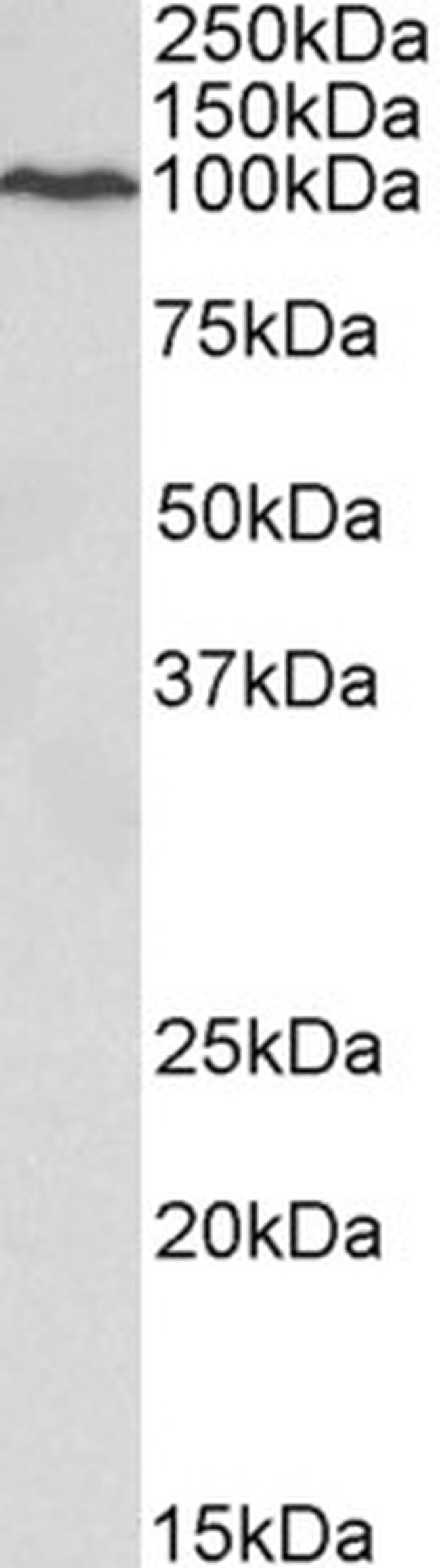 VCP Antibody in Western Blot (WB)