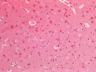 VCP Antibody in Immunohistochemistry (Paraffin) (IHC (P))