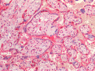 VCP Antibody in Immunohistochemistry (Paraffin) (IHC (P))