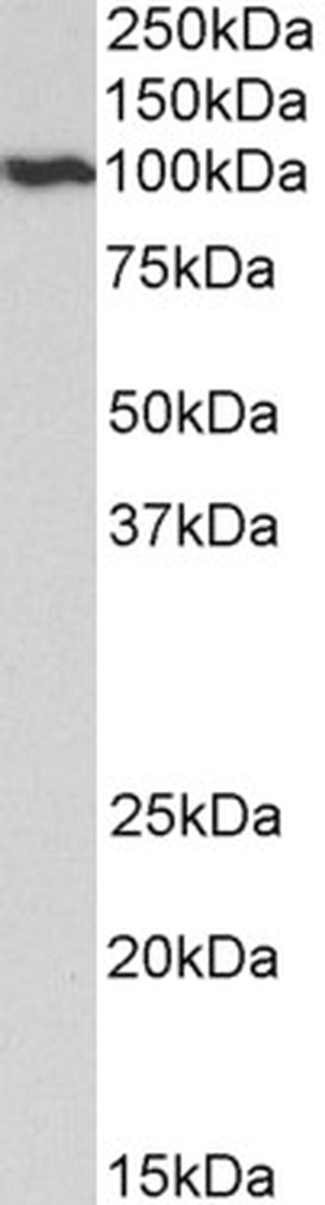 VCP Antibody in Western Blot (WB)